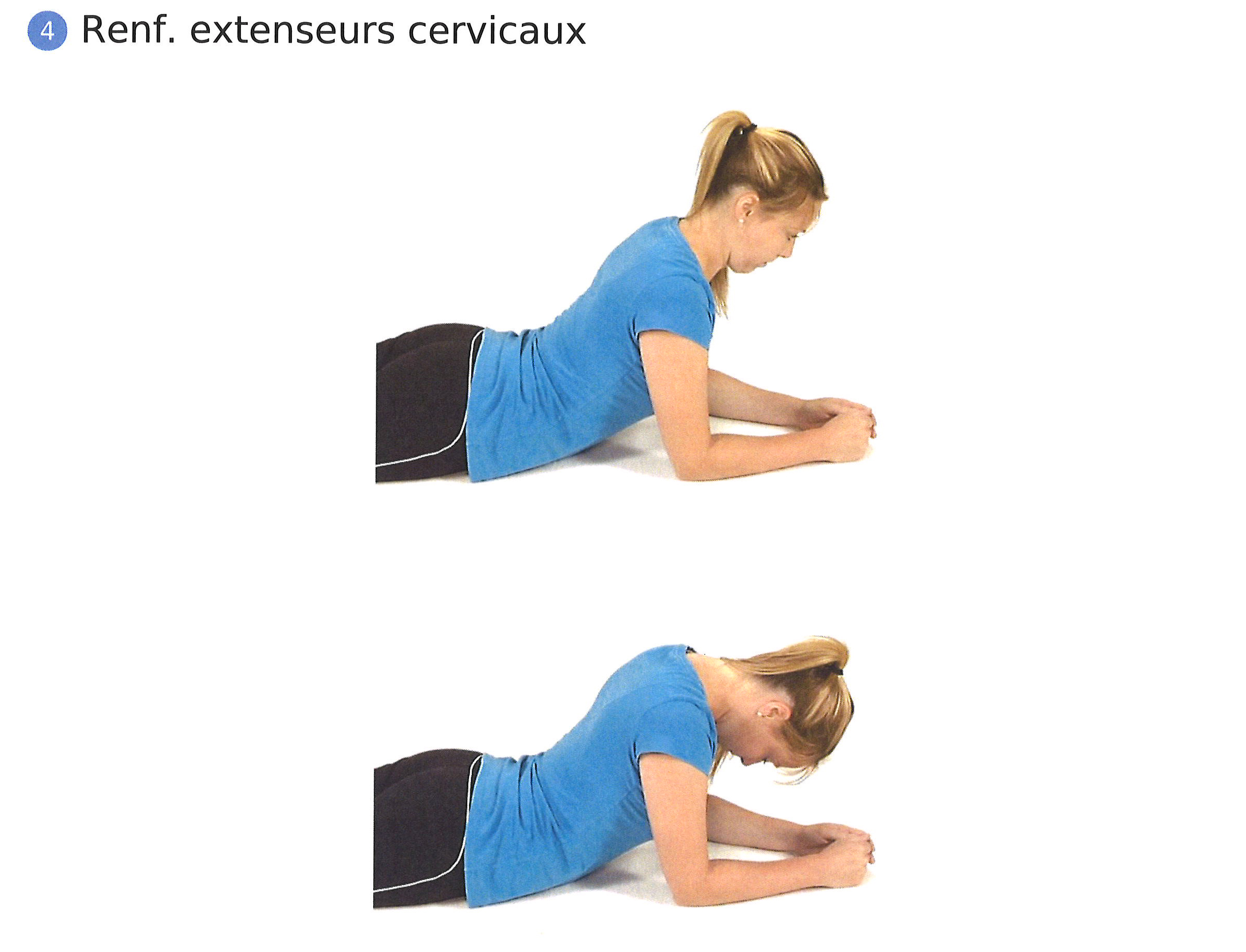physio exercice hernie discale cervicale renforcement extenseurs cervicaux